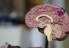 Nobody Is Left-Brained. The Man Who Won the Nobel for Split Brains Said So Himself. An anatomical model of a human brain