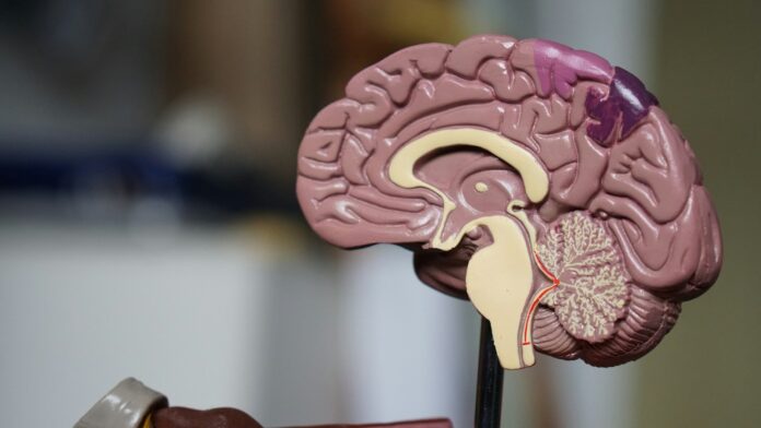 An anatomical model of a human brain